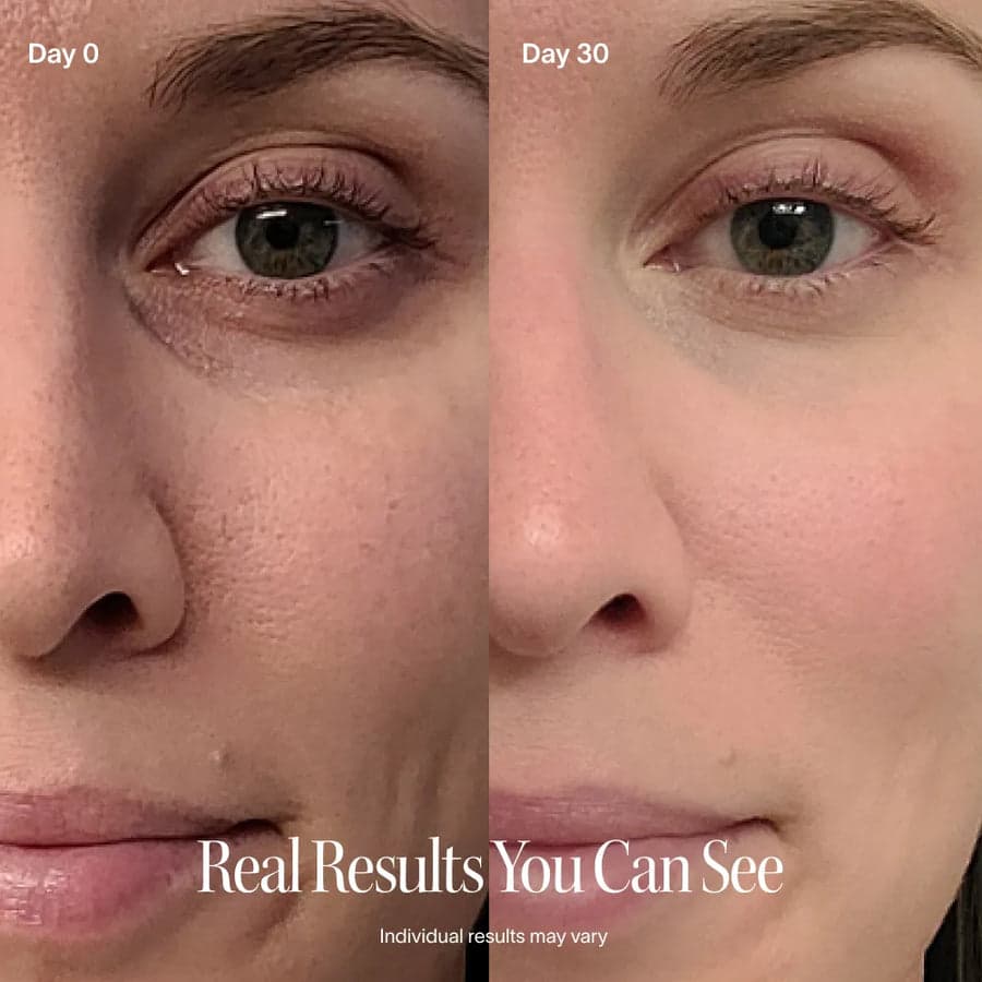 Day 0 vs Day 30 — real results you can see
